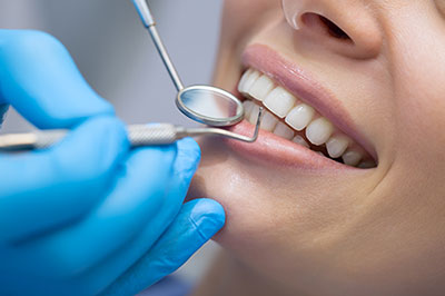 A dental professional performing a teeth cleaning procedure on a patient, with the patient smiling and wearing blue gloves.