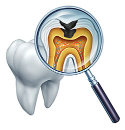 An illustration of a magnified tooth with an x-ray image showing the interior, including roots and pulp chamber, viewed through a magnifying glass.