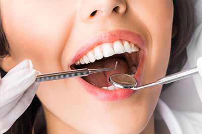 A woman with a large smile is receiving dental treatment, with a dentist working on her teeth and a dental implant visible in her mouth.