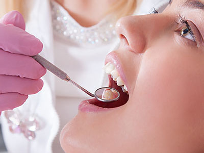 A dental professional is performing a teeth cleaning procedure on a patient s mouth, with the patient s open mouth visible and a dental mirror being used.